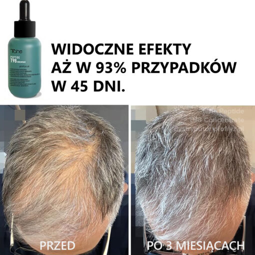 Koncentrat z peptydami przeciw wypadaniu włosów Tahe Peptide T98 profryz.pl